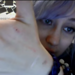 Zoe Quinn Implants Chip in Her Arm